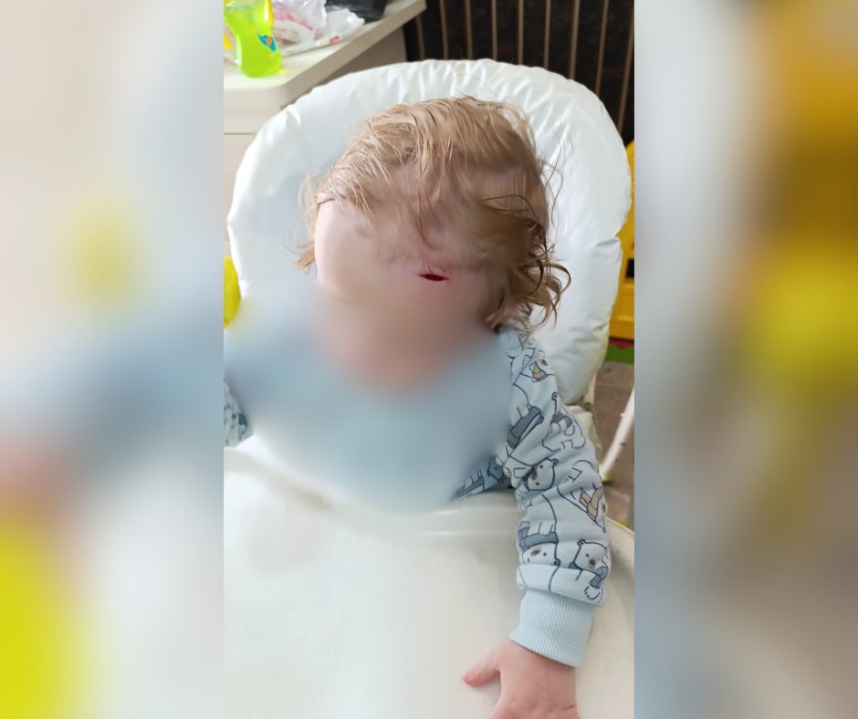 בנה של ח' והחבלה בראשו. קרדיט: תוכן גולשים ע"פ סעיף 27א'